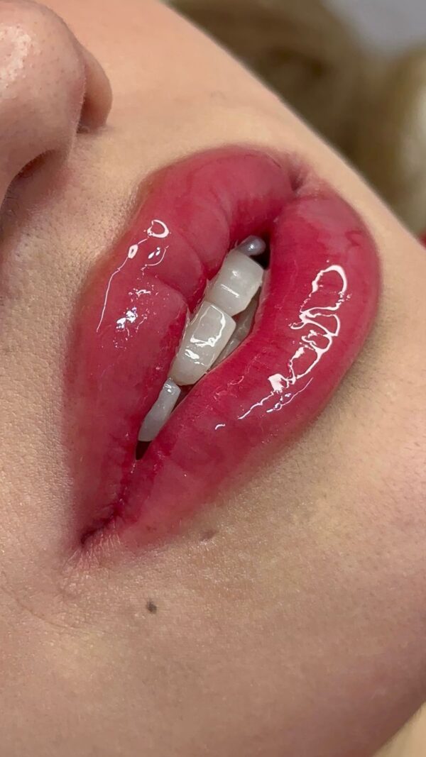 Hidra Gloss Lips