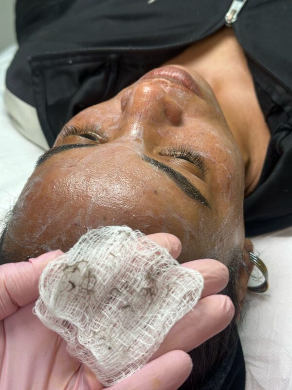 Limpeza de pele + Dermaplaning